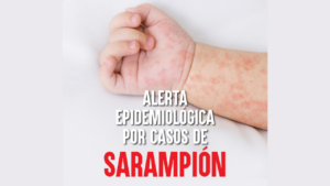 Hasta el lunes 16 de febrero el país reportó 345 casos de sarampión. Sololá y Guatemala son quienes más positivos documentan.